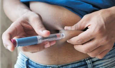 Le succès sur TikTok d'une pilule minceur inquiète les médecins et les autorités