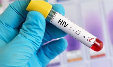 Gatsibo:Mu rubyiruko haracyagaragara abaha akato abafite ubwandu bwa virus itera sida.