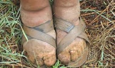 Nyamasheke: Hari abakora mu nzego z’ubuzima badasobanukiwe uburwayi bw’imidido!