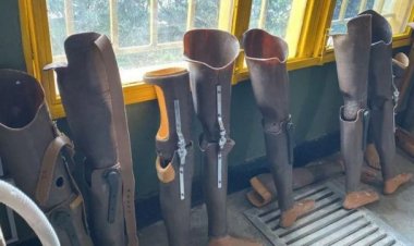 Abafite ubumuga bw’ingingo barasaba koroherezwa  kubona insimburangingo zigezweho.