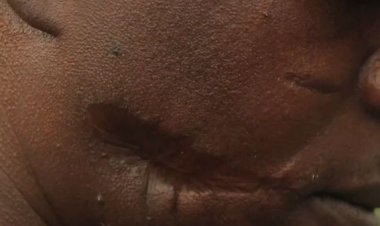 Nyabihu-Bigogwe: Barinubira gukubitwa n’abayobozi