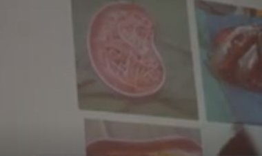 Abanyamadini barasabwa kugira uruhare mu kurwanya indwara zititaweho