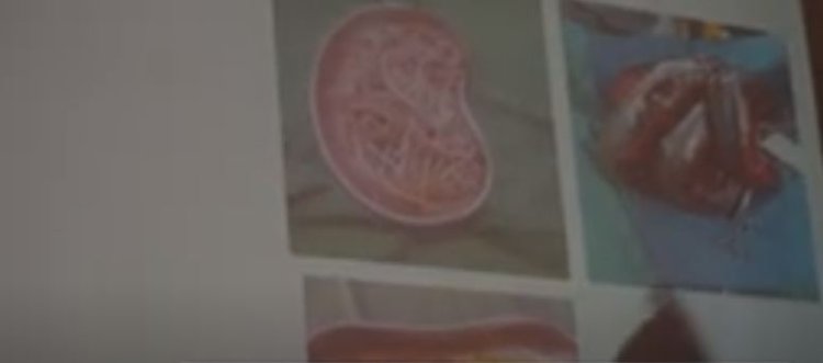 Abanyamadini barasabwa kugira uruhare mu kurwanya indwara zititaweho