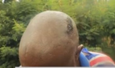 Musanze:Bahangayikishijwe n’urugomo rukorwa n’abanyoye ibiyobyabwenge