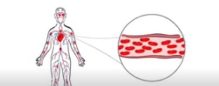 Bahangayikishijwe n’indwara y’umuvuduko w’amaraso