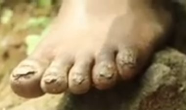 MUSANZE: Barataka kurogwa amavunja akagera no mu myanya y’ibanga