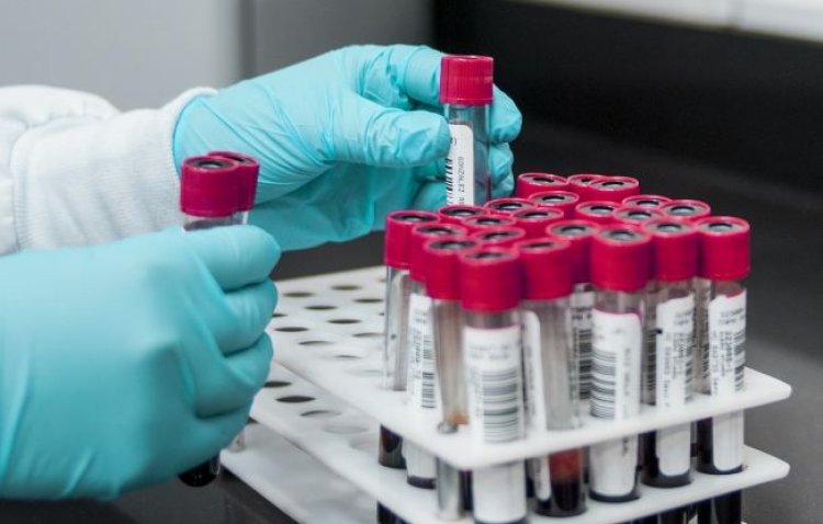 Barinubira amwe mu mavuriro akorera inyungu zayo kurusha ababagana