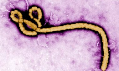 Amerika yatangaje inkunga ya miliyoni $13 yo guhangana na Ebola muri RDC na Uganda